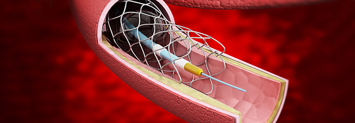 what is a heart cath