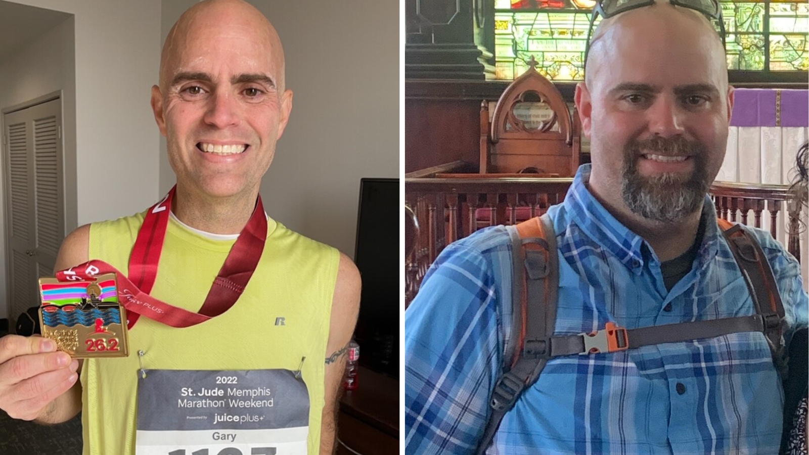 Gary After and Before Weight Loss Surgery